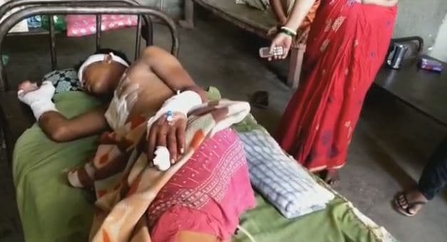 बेगूसराय में शख्स पर बम से हमला, मामले की जांच में जुटी पुलिस